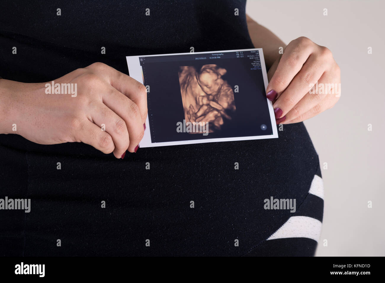 Frau mit unborn Baby Sonographie Bild in den Händen, vor dem Bauch. Stockfoto