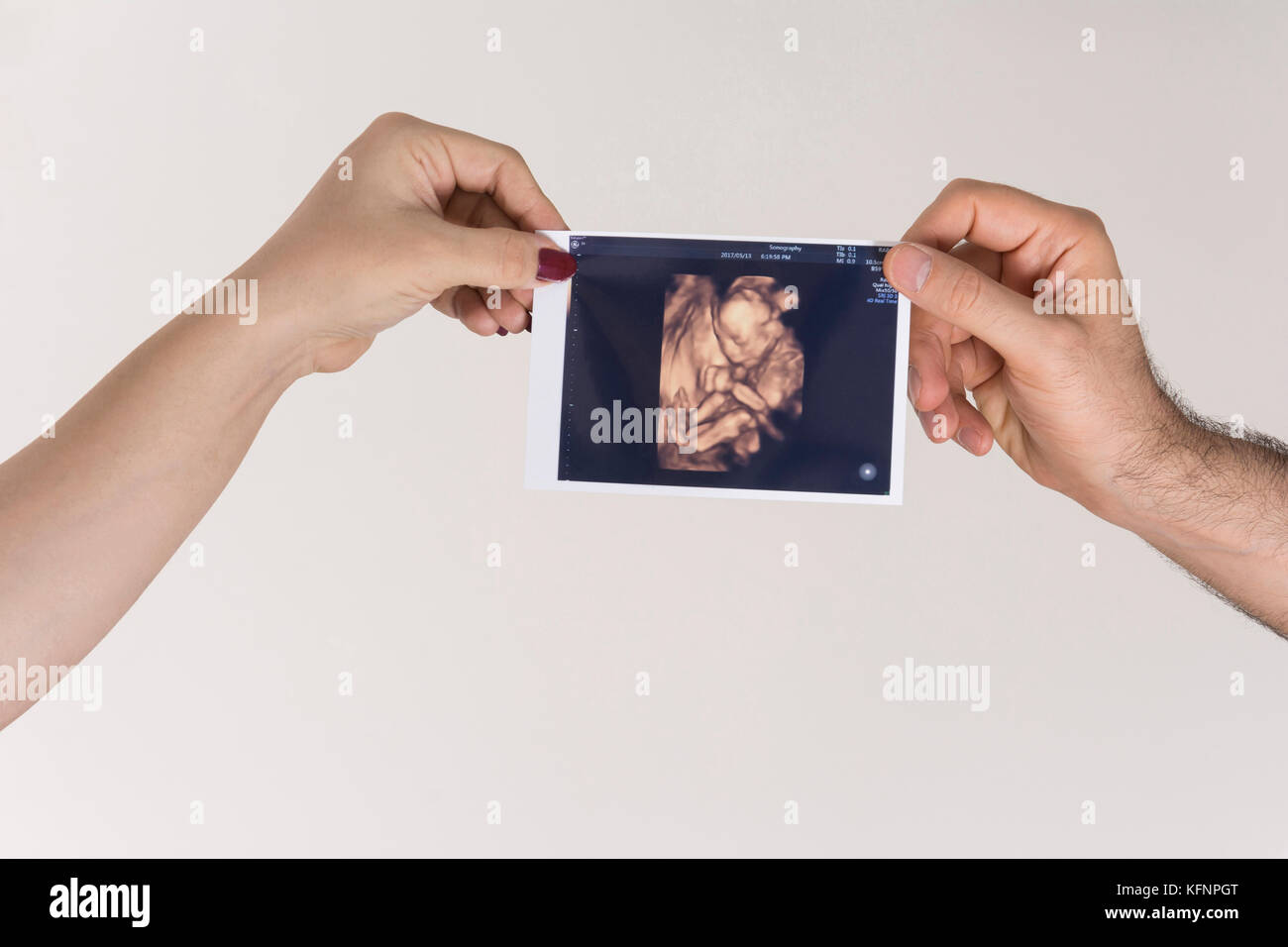 Übergeordnete Holding unborn Baby Sonographie Bild in der Hand, vor weißem Hintergrund. Stockfoto