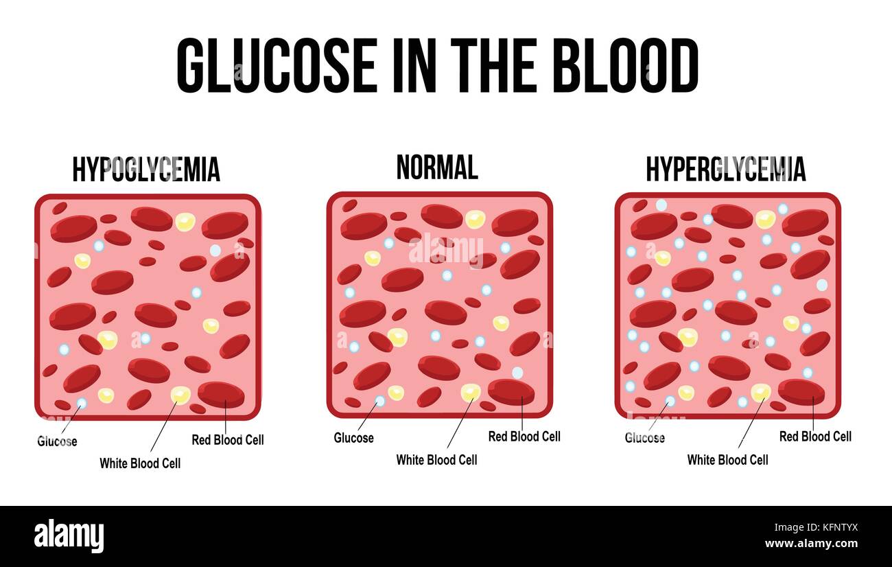 Glukose im Blut, Grafik, Vector Illustration (für grundlegende medizinische Ausbildung, für Kliniken & Schulen) Stock Vektor