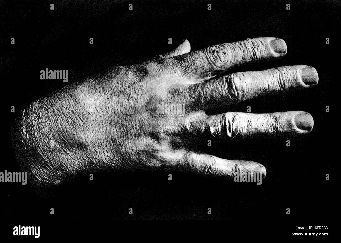 Franz Liszts mit der rechten Hand. Gips. Ungarische Pianist und Komponist, 22. Oktober 1811 - vom 31. Juli 1886. Stockfoto