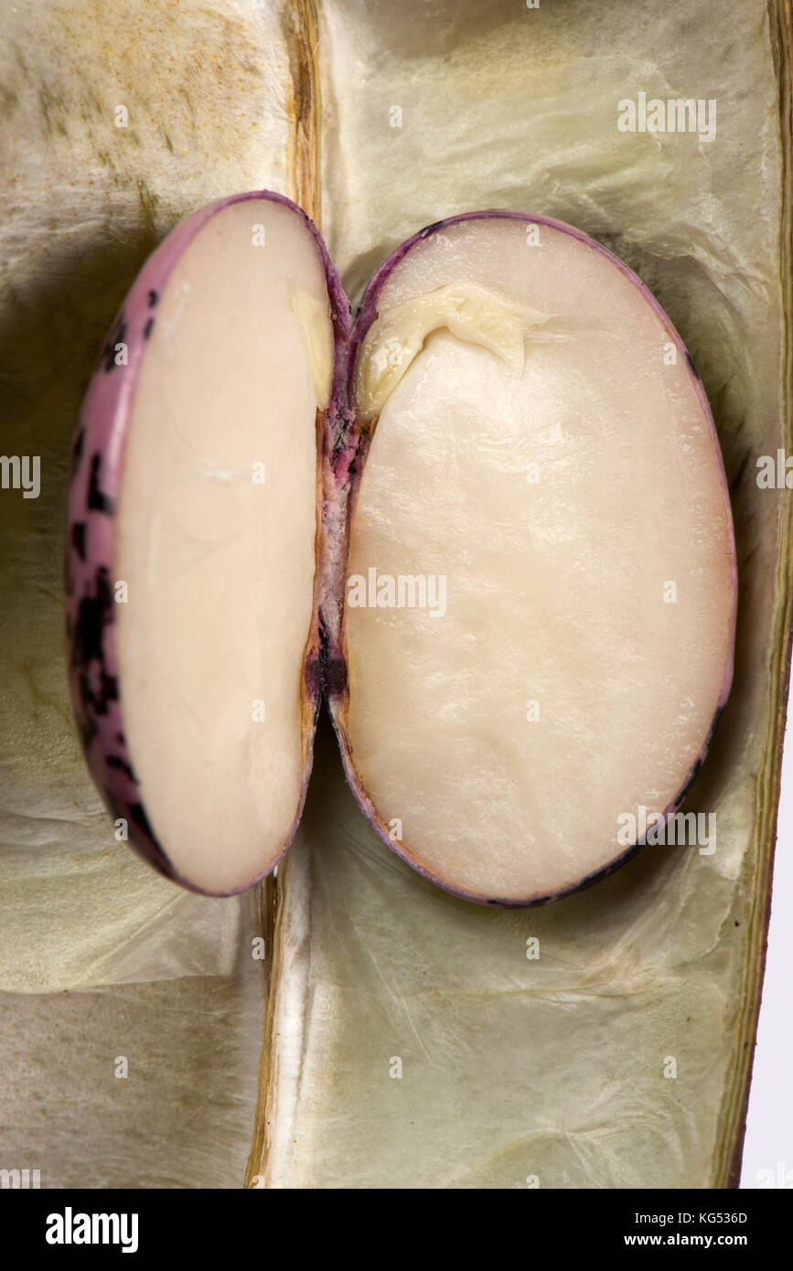 Trockene verschüttete Saatgut einer Prunkbohne, Phaseolus coccineus, embryo Keimblätter, Hypokotyl, plumule und root-apis Stockfoto