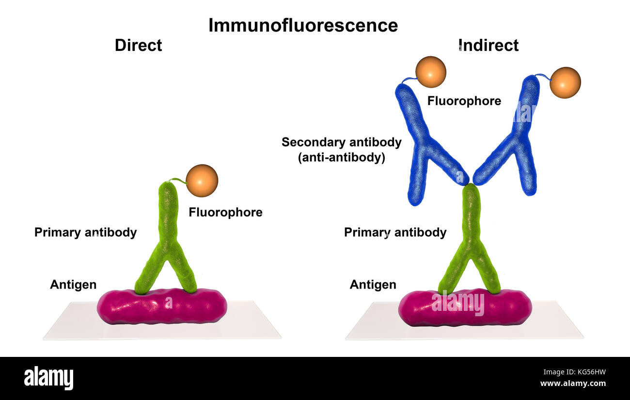 Mechanismus der indirekte Immunfluoreszenztest, computer Abbildung. Immunfluoreszenz ist ein cell imaging Technik basiert auf der Verwendung von Antikörpern gegen das Label ein spezifisches Ziel Antigen (Bakterien, Krebszellen, Andere) mit einem fluoreszierenden Farbstoff (auch als fluorophor oder FLUOROCHROM). Die fluoreszierenden Farbstoff ermöglicht die Visualisierung des Antigens Verteilung in der Stichprobe unter einem Fluoreszenz-mikroskop. Die indirekte Immunfluoreszenz verwendet zwei Antikörper, die primären und die sekundären. Stockfoto