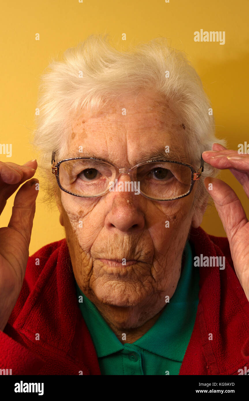 Ältere Frau leidet Makuladegeneration in ihren Augen Stockfoto