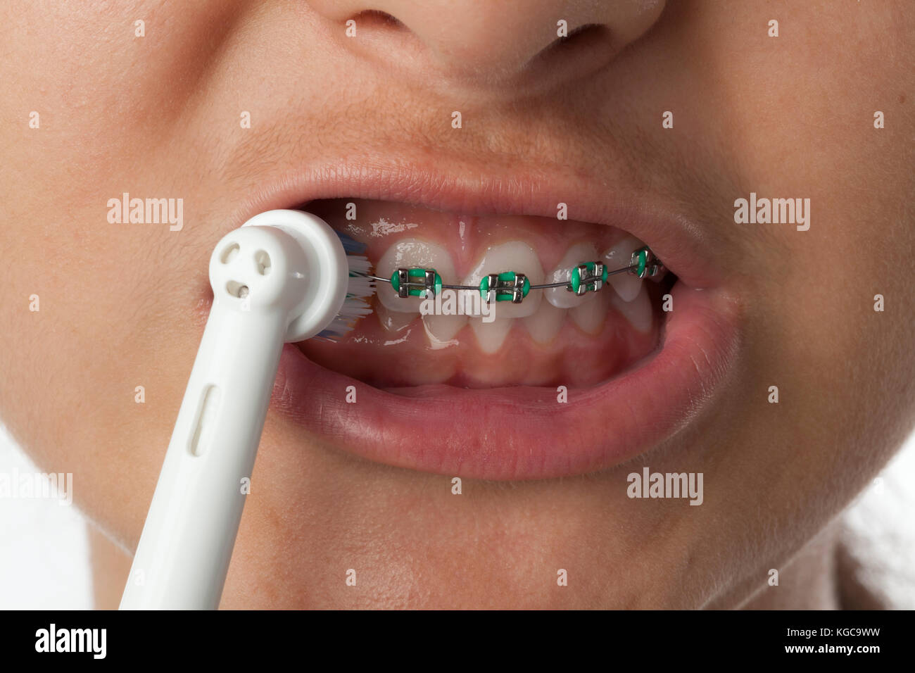 Teenage Girl ist das putzen ihre Zähne mit Zahnspangen mit einer elektrischen Zahnbürste Stockfoto