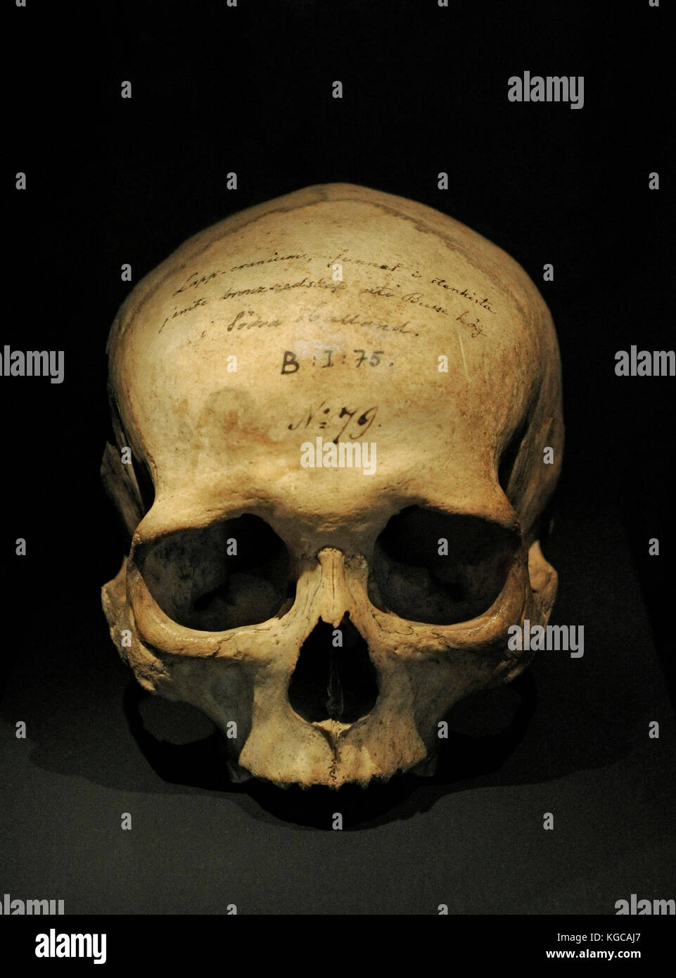 Menschlicher Schädel in einer funerary Damm entfernt. 1700-500 a.c. hasslow, halland Region. Historische Museum. Stockholm Schweden. Stockfoto