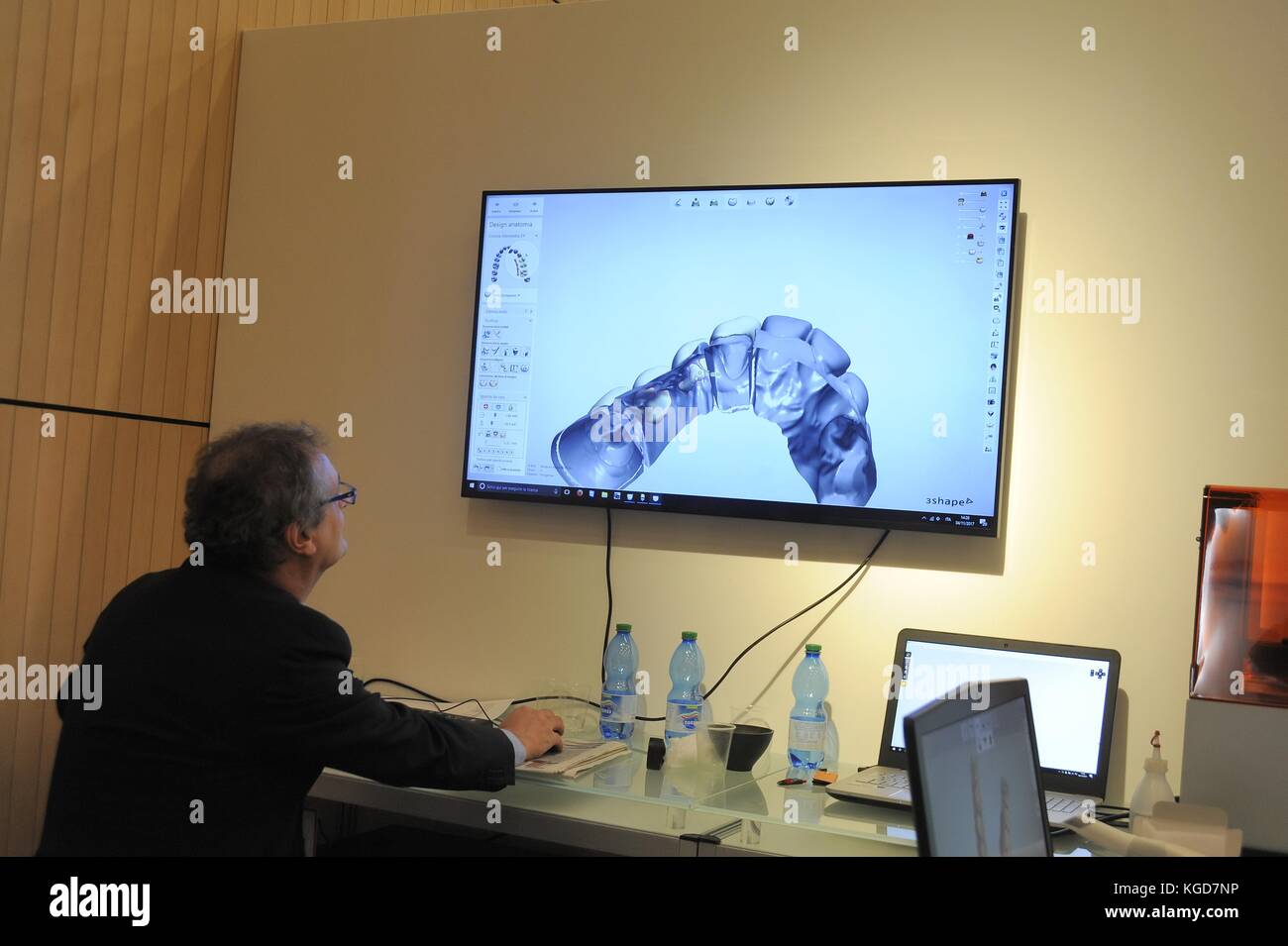 Italienischen Akademie für Zahnärztliche prothetische Zahnheilkunde (Aiop), Realisierung einer Prothese durch 3D-Scannen und cad-cam-Design Stockfoto
