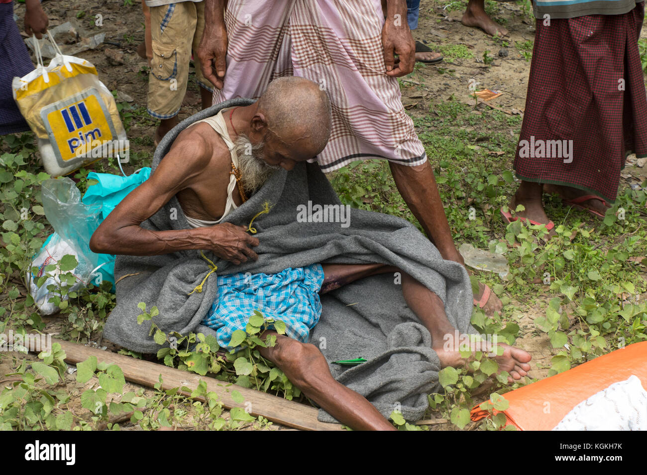 Verletzte Rohingya in Bangladesch Stockfoto