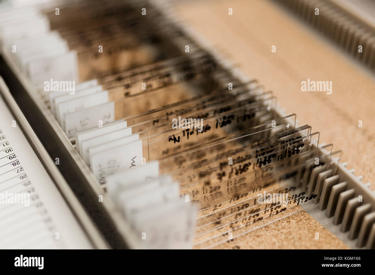 Close-up verschiedener Objektträger in Container im Labor Stockfoto