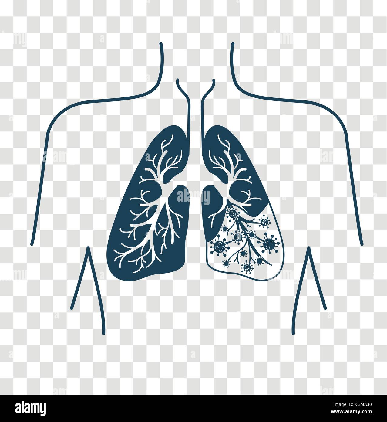 Symbol der Lungenkrankheit, Pneumonie, Asthma, Krebs in der Form von Lungenkrebs Anatomie und Viren, Bakterien, Krankheit verursachen. Symbol, Silhouette in einem linearen Stil Stock Vektor
