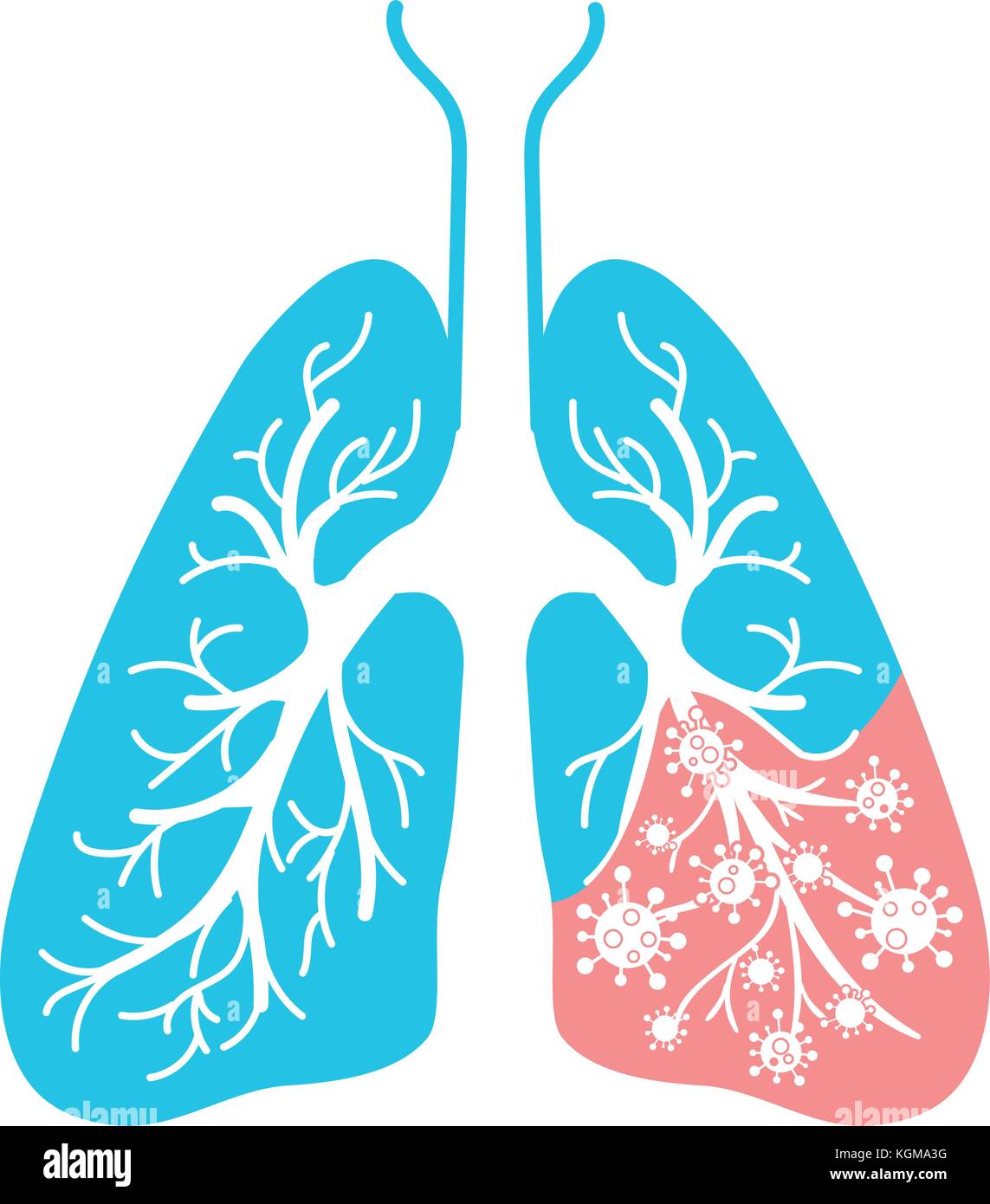 Symbol der Lungenkrankheit, Pneumonie, Asthma, Krebs in der Form von Lungenkrebs Anatomie und Viren, Bakterien, Krankheit verursachen. Symbol in linearen Stil Stock Vektor