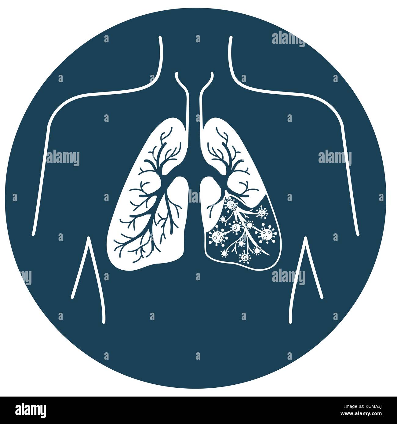 Symbol der Lungenkrankheit, Pneumonie, Asthma, Krebs in der Form von Lungenkrebs Anatomie und Viren, Bakterien, Krankheit verursachen. schwarz-weiß illustration Stock Vektor