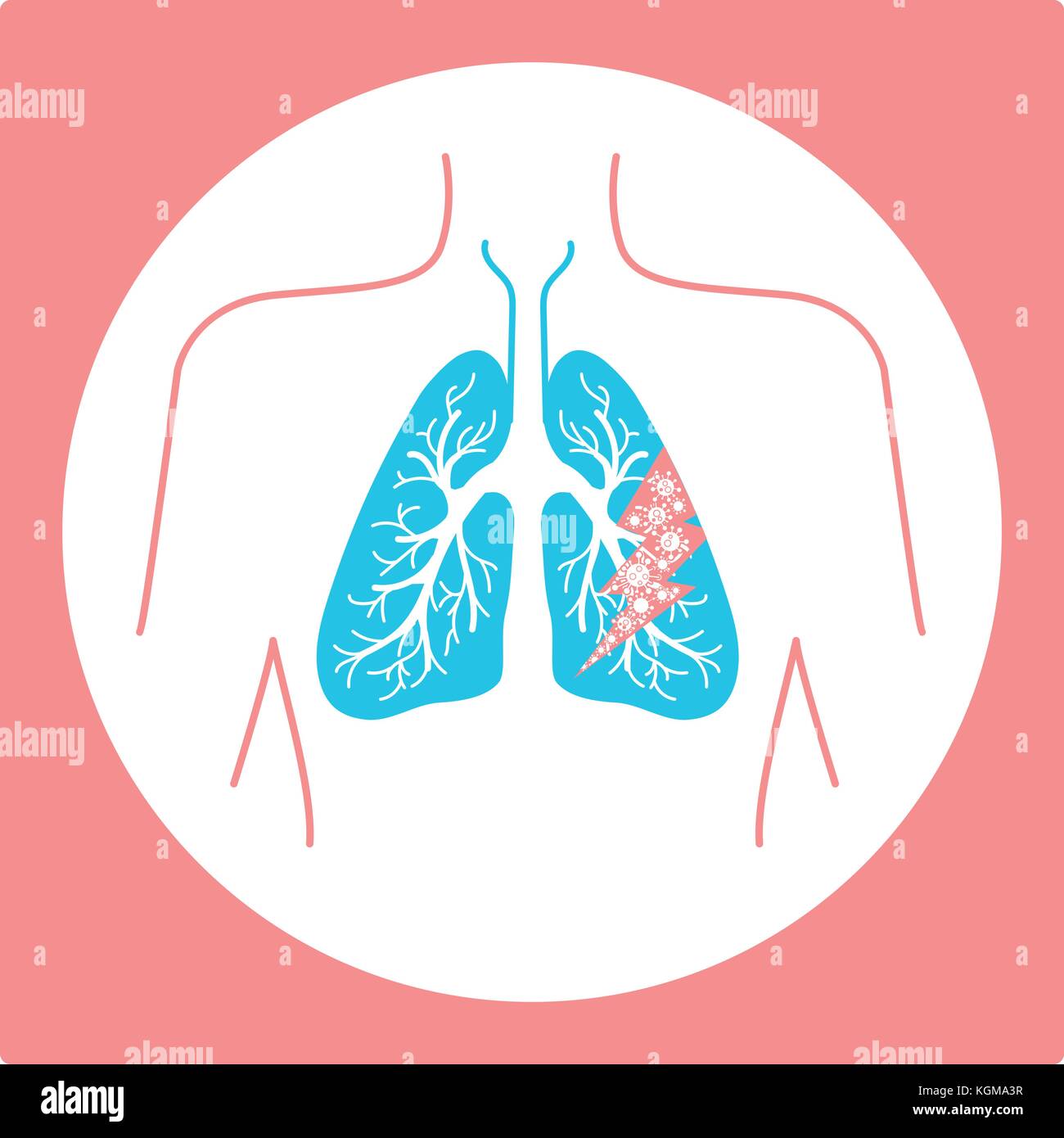 Symbol der Lungenkrankheit, Pneumonie, Asthma, Krebs in der Form von Lungenkrebs Anatomie und Viren verursacht Krankheit. Symbol in linearen Stil Stock Vektor
