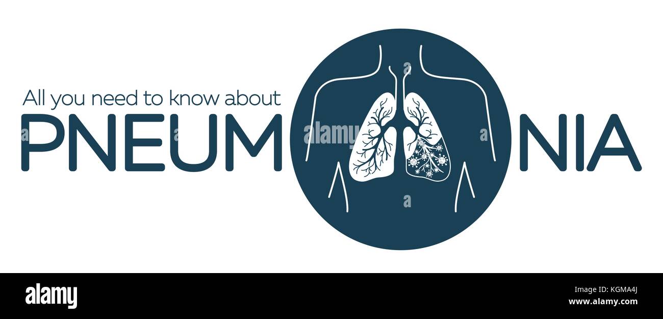Informationen Banner über Lungenentzündung in Form von Anatomie der Lunge und Bakterium verursacht Krankheit. Abbildung im linearen Stil Stock Vektor