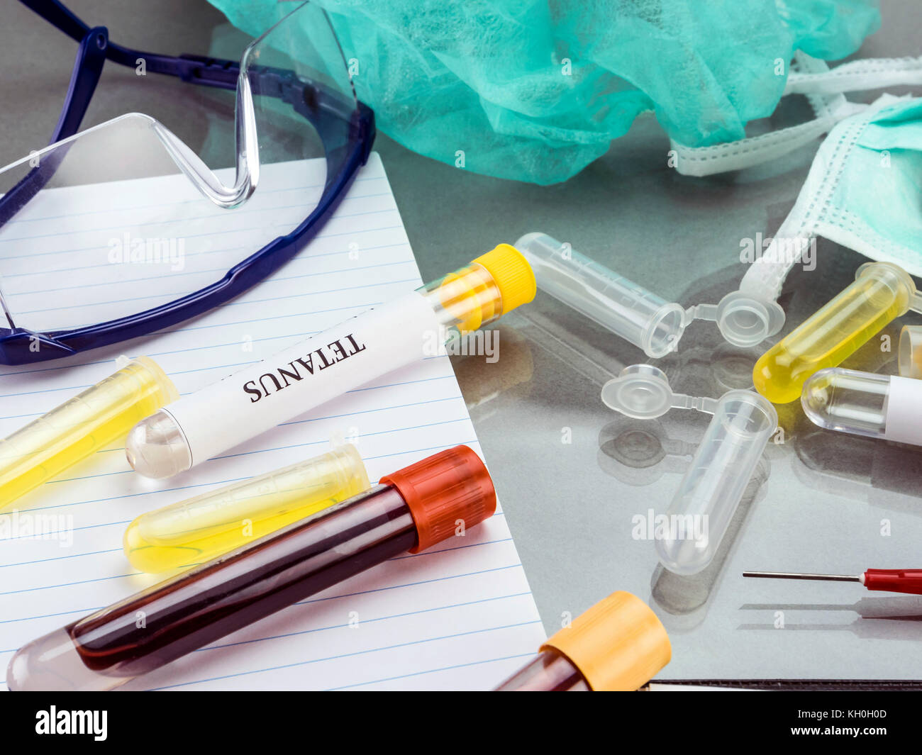 Einige Fläschchen mit Proben von ansteckenden Krankheiten in einem klinischen Labor Stockfoto