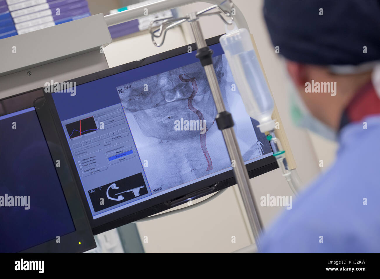Ein Monitor mit x-ray scull Katze Bild scannen im modernen Krankenhaus. Stockfoto