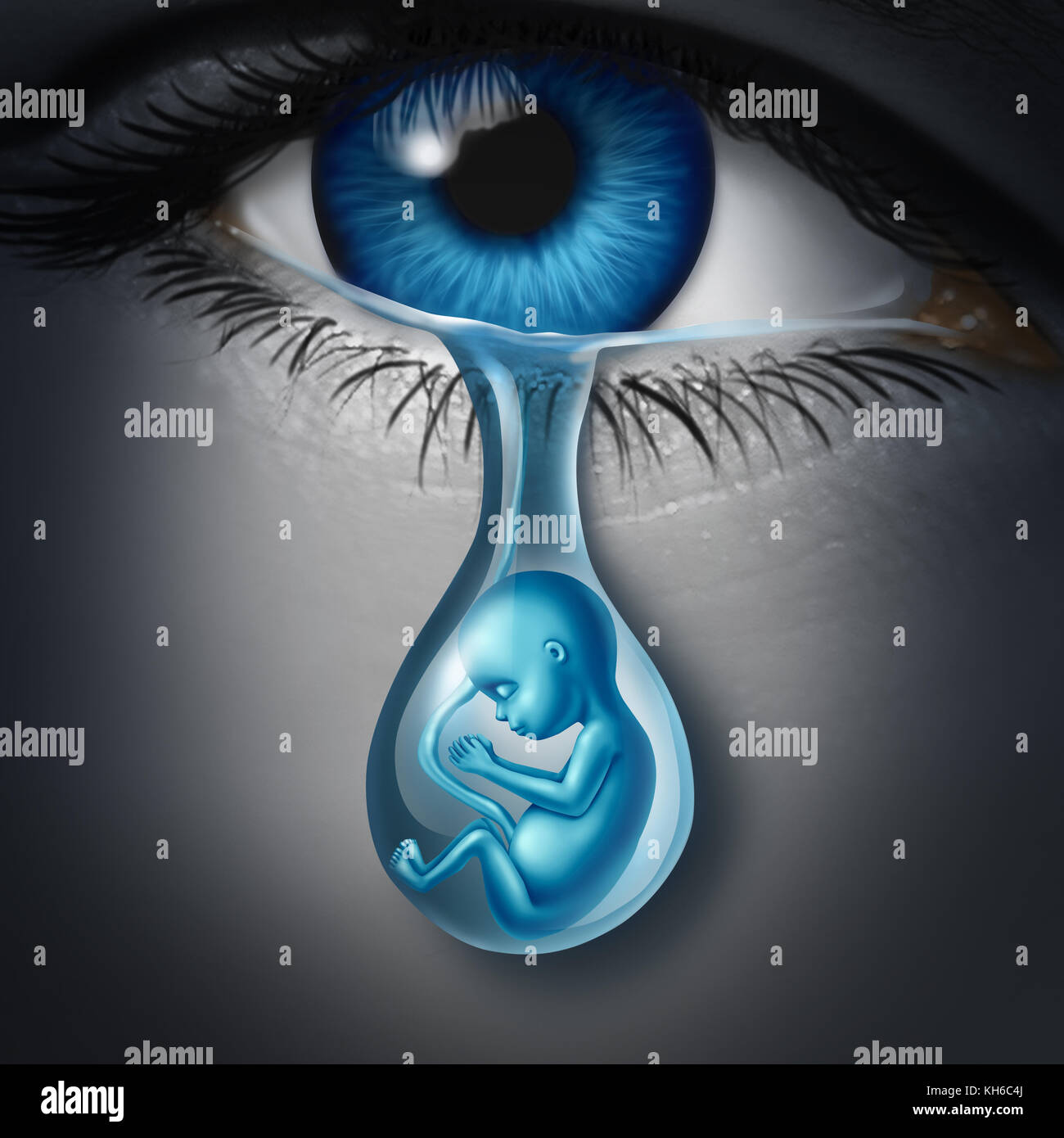 Schwangerschaft Depression medizinisches Konzept und Psychologie Symbol für eine Schwangere zukünftige Mutter und depressiven Frau als aus einem traurigen Träne. Stockfoto