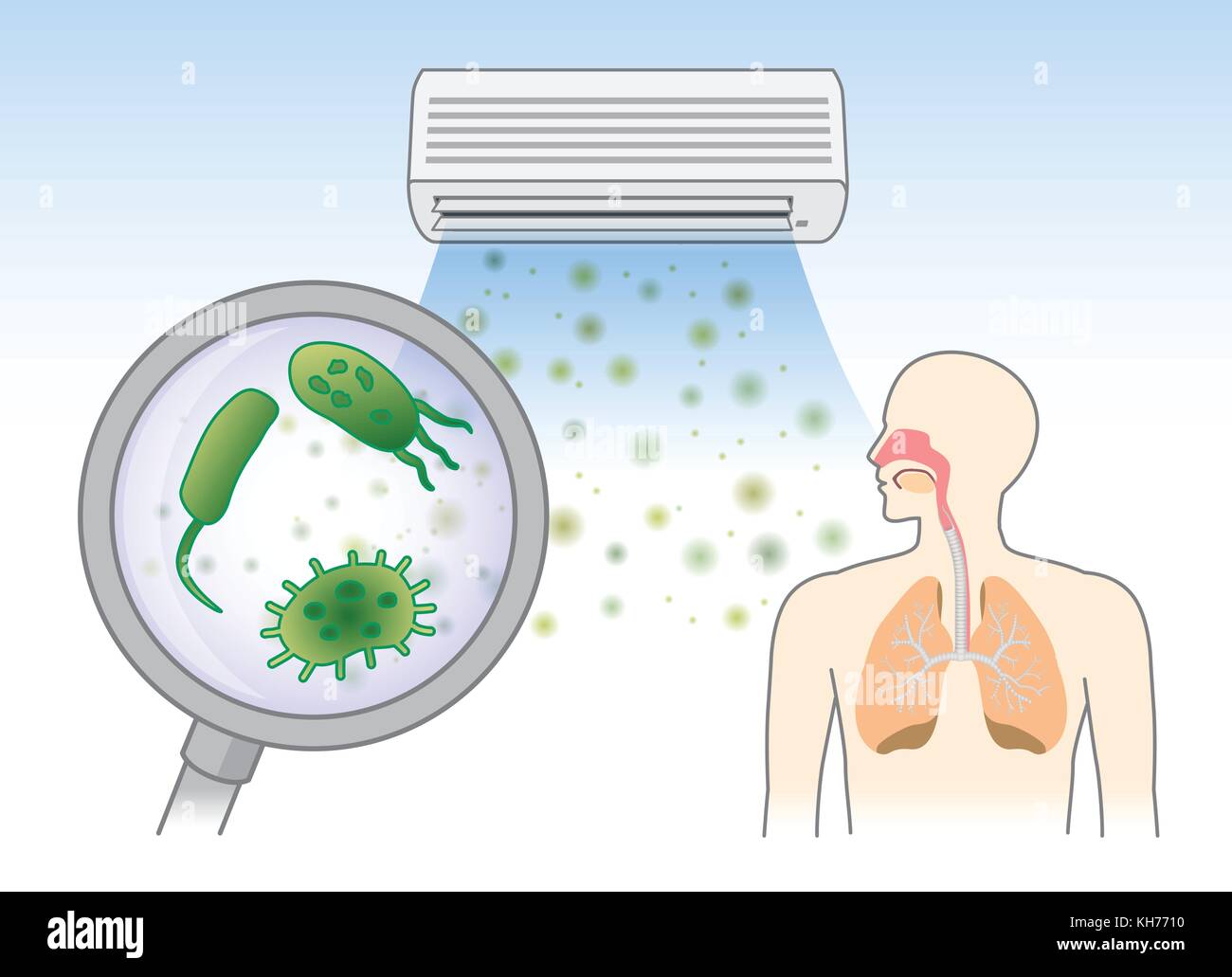 Bakterien im Staub von Air Conditioner in der Atemwege mit dem Atem. Stock Vektor