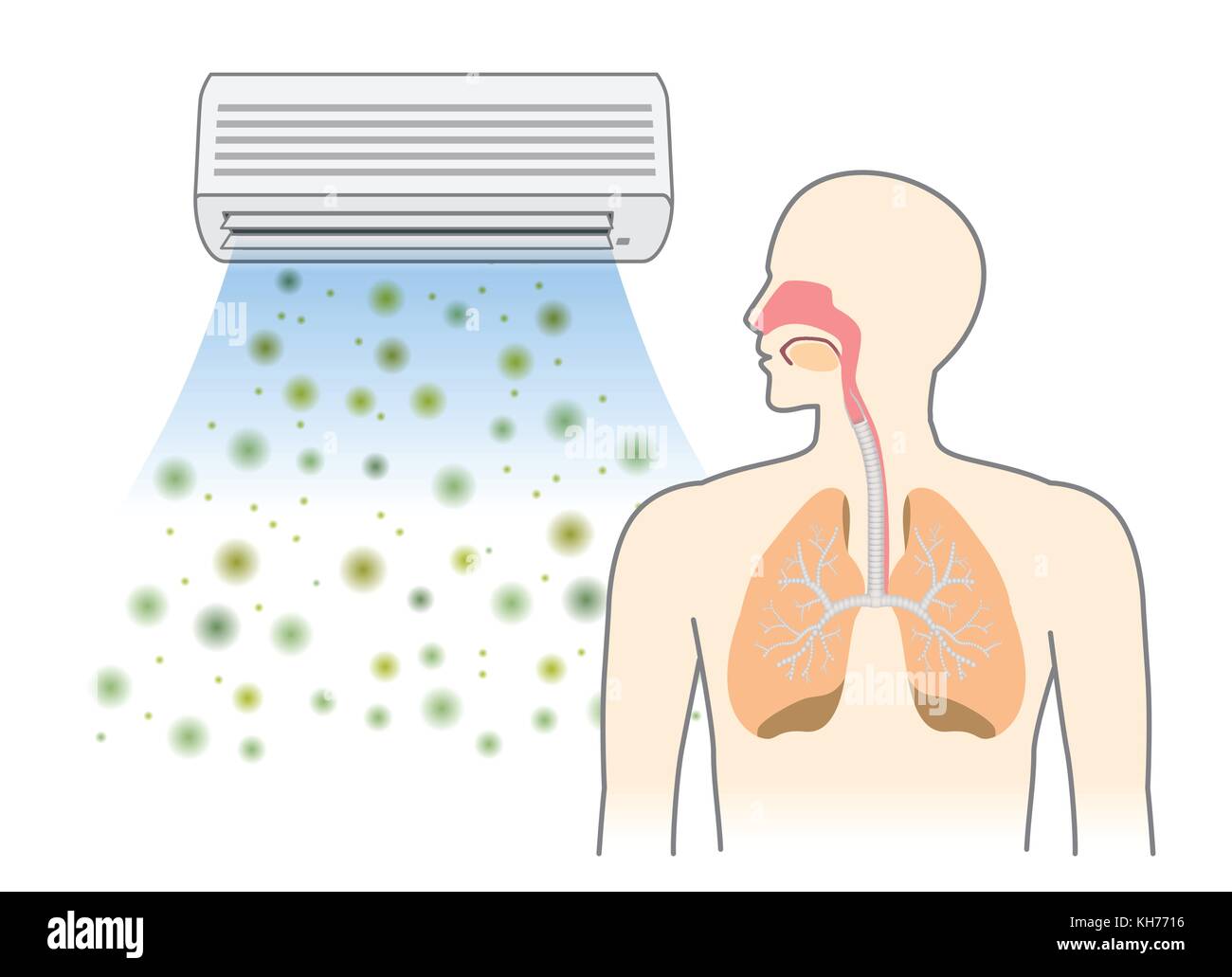 Staub und Schmutz von der Klimaanlage in der Atemwege mit der Atmung Stock Vektor