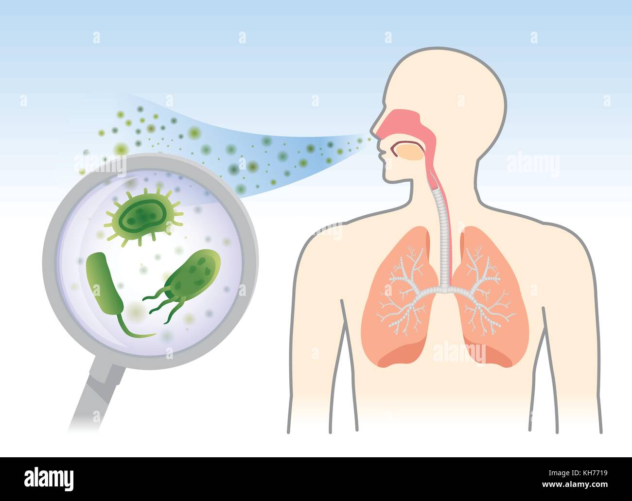 Suche Bakterien und Pilze in der Atemwege des Menschen von Atmen. Stock Vektor