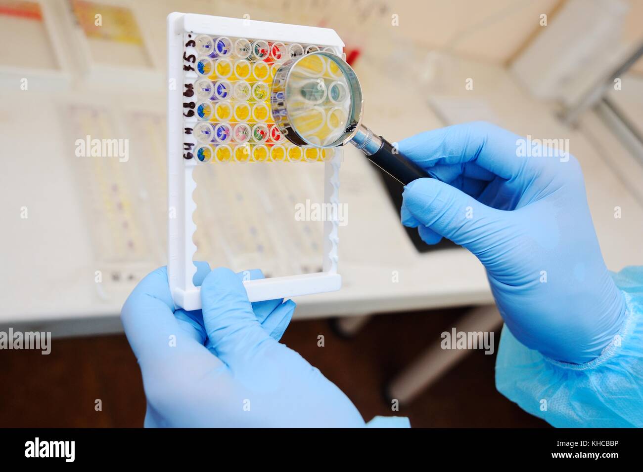 Eine Laborantin oder ein Wissenschaftler untersucht durch ein Vergrößerungsglas bakteriellen Tests Stockfoto