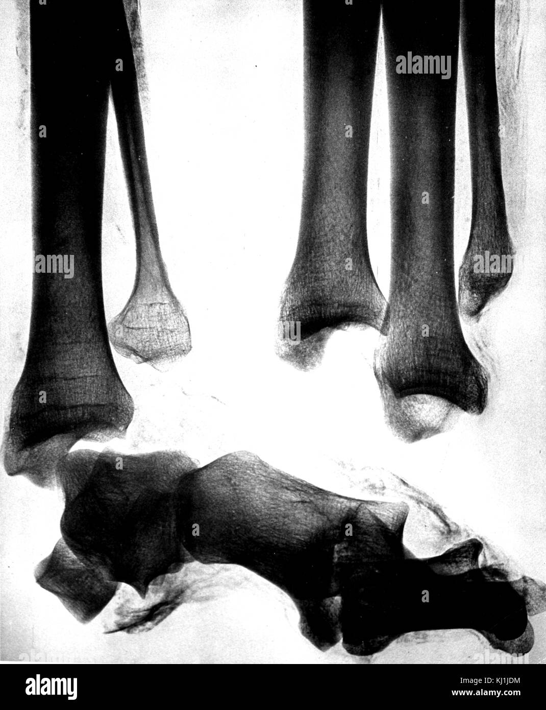 X-ray Bilder der Beine eines alten ägyptischen Mumie erstellt kurz nach Ankündigung von Wilhelm Röntgen die Entdeckung der Röntgenstrahlen. Wilhelm Röntgen (1845-1923) eine Deutsch/Niederländische Maschinenbauer und Physiker. Vom 19. Jahrhundert Stockfoto