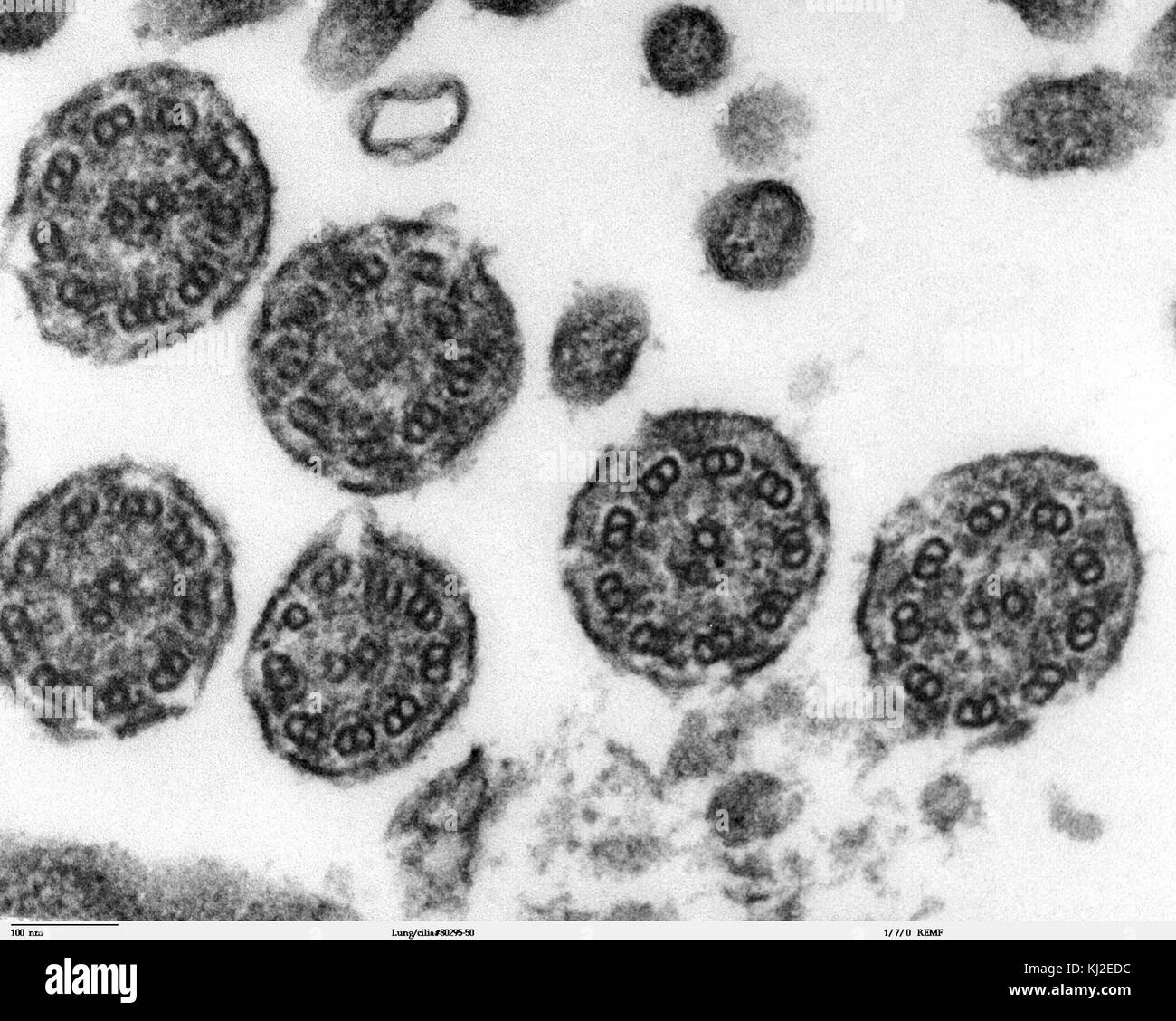Bronchiolar Bereich zilien Querschnitte 1. Stockfoto