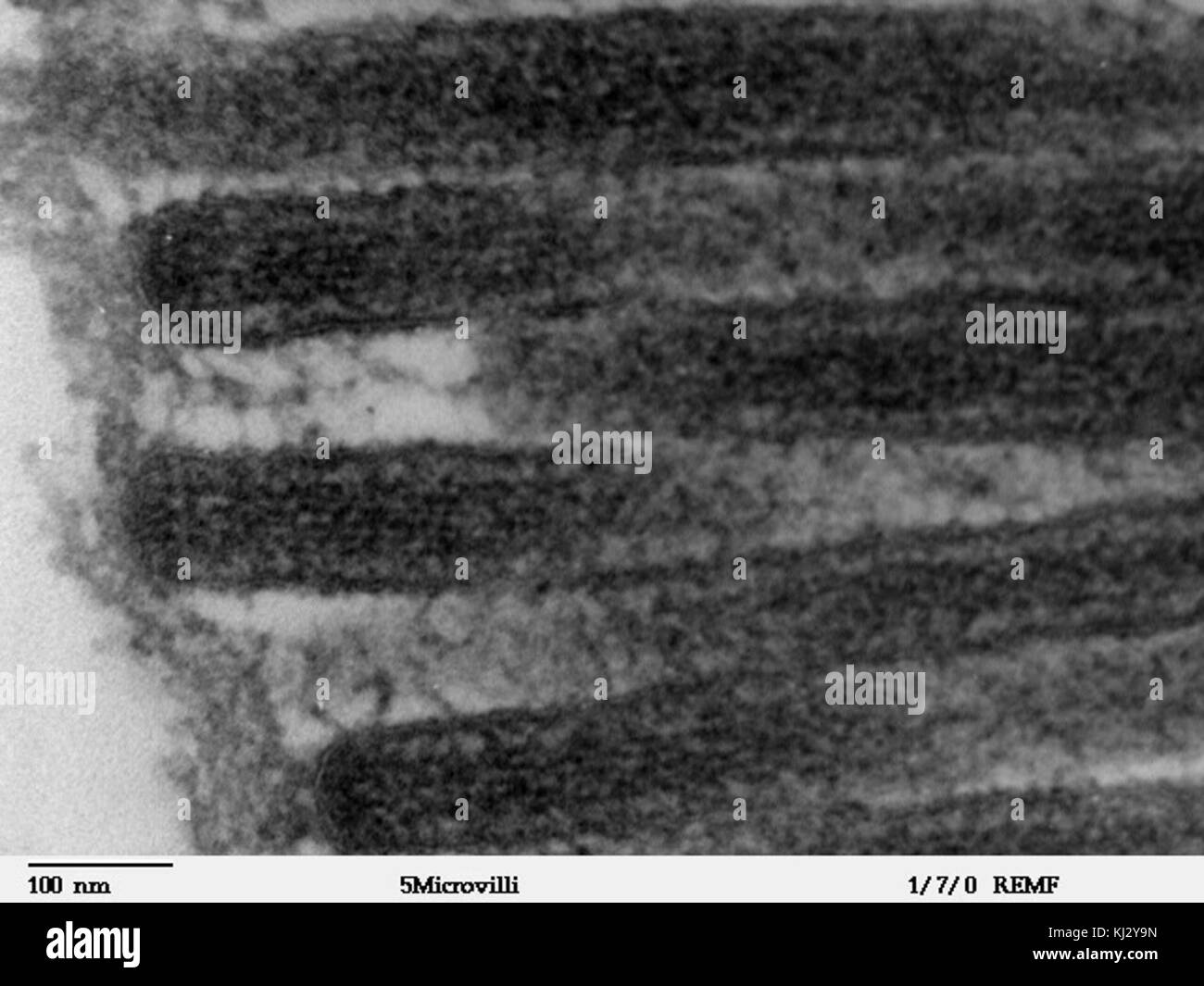 Dieses Transmissionselektronenmikroskop (TEM)-Bild zeigt die detaillierte Struktur der Mikrovilli im menschlichen Jejunum. Diese mikroskopischen Strukturen sind für die Nährstoffaufnahme im Verdauungssystem von entscheidender Bedeutung. Stockfoto