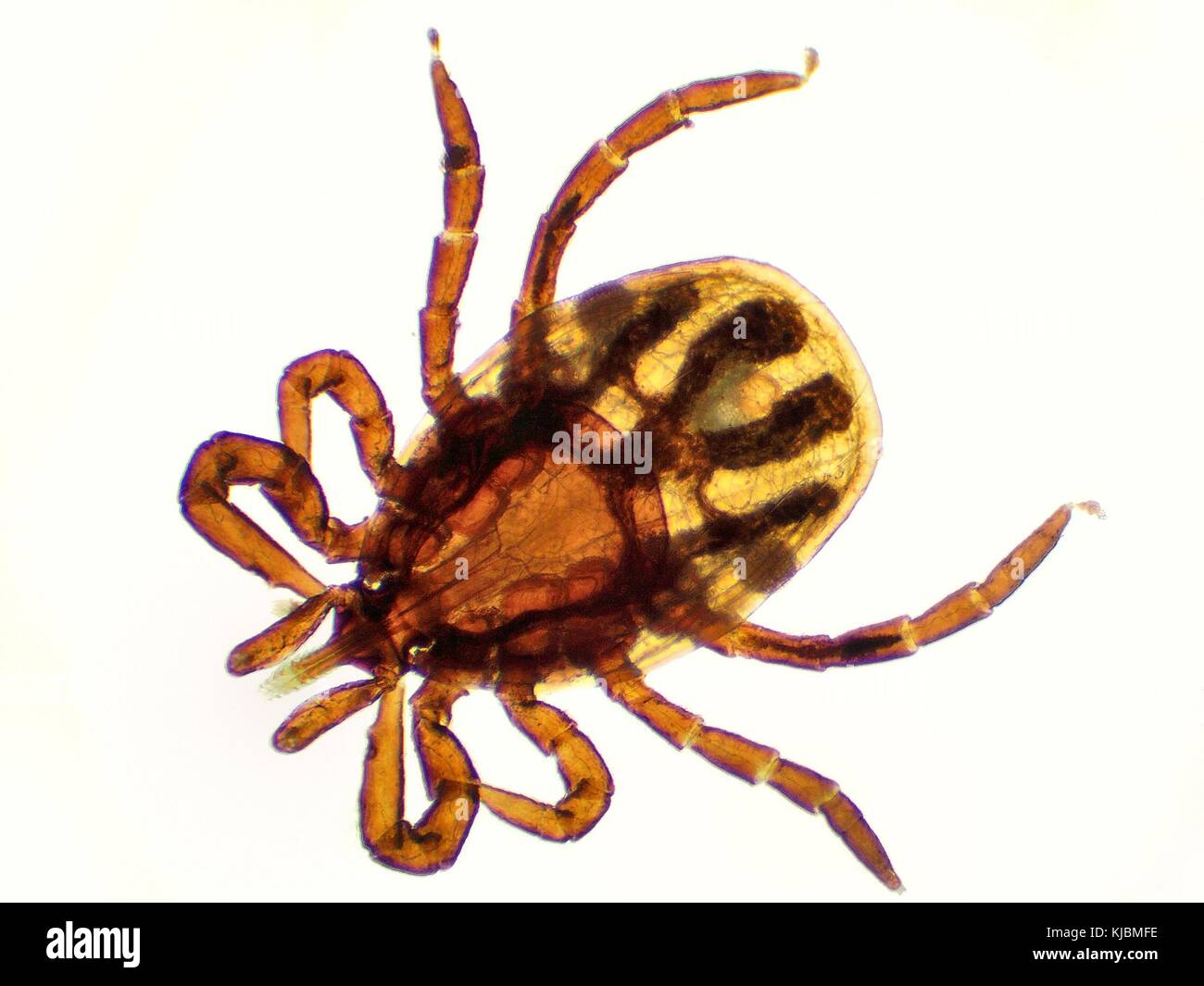 Der Castor bean Zecke (Ixodes ricinus) unter dem Mikroskop. Häßlich Zecke  mit weißem Hintergrund Stockfotografie - Alamy