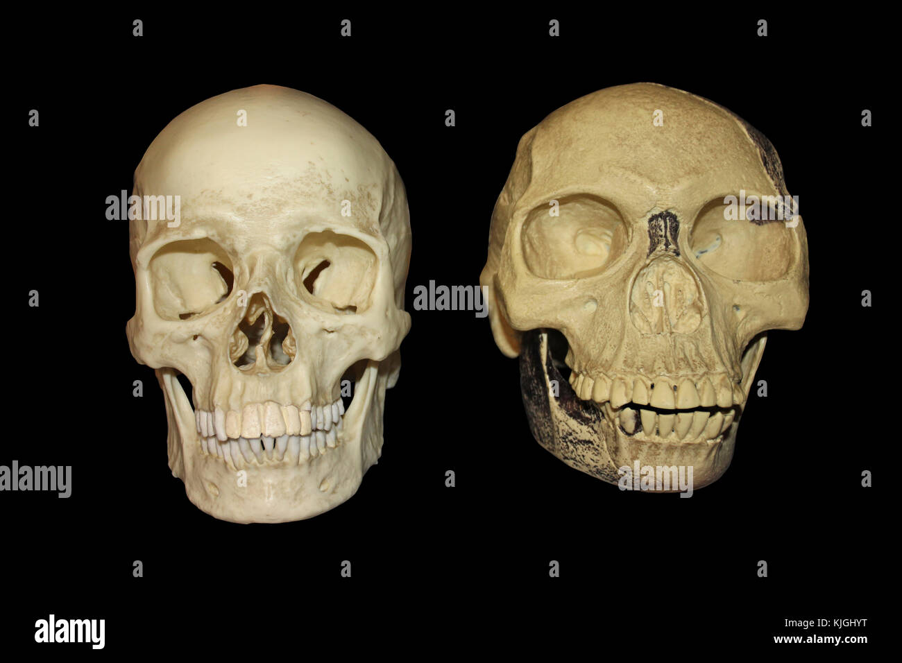 Vergleich Piltdown Man vs modernen menschlichen Schädel Vorderansicht Stockfoto