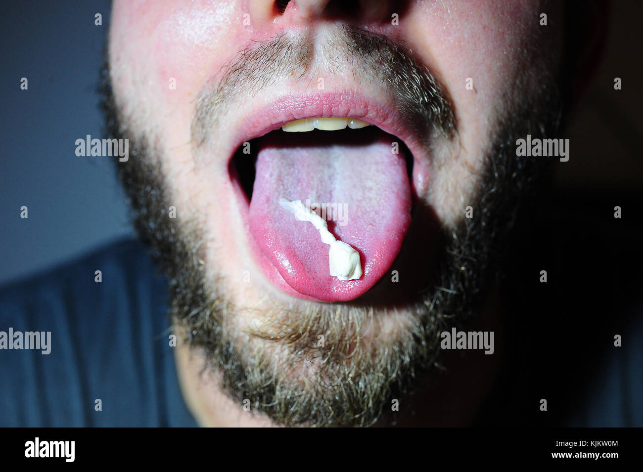 Mann mit ectasy Droge auf seiner Zunge. Frankreich. Stockfoto