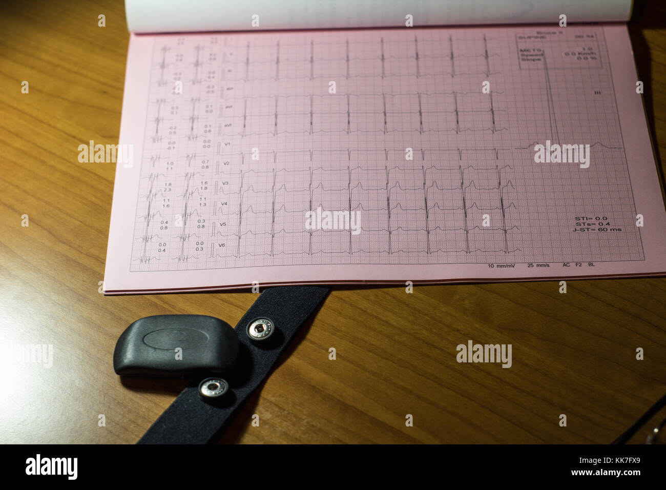 Eine electrokardiogram Druckbogen auf einem Doktorbüro Nahaufnahme Stockfoto