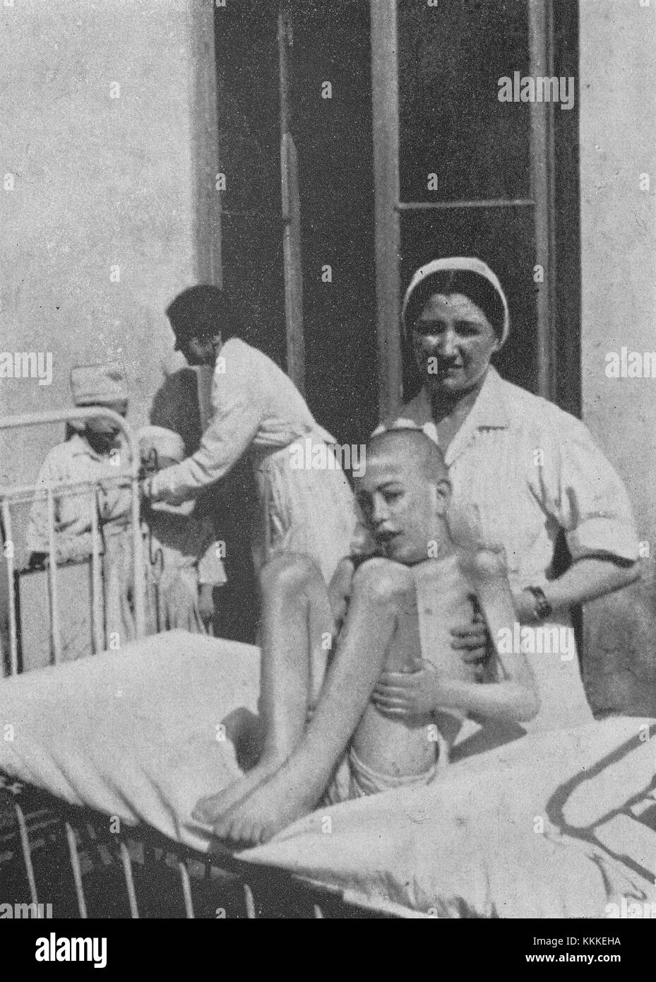 1942 wurde im Warschauer Ghetto im Rahmen einer Studie über die Auswirkungen extremer Mangelernährung bei Hungersnöten eine klinische Forschung zu Hungerkrankheiten durchgeführt. Diese Forschung hat zu unserem Verständnis von Hungersnot-bedingten Krankheiten und ihren Auswirkungen auf die Gesundheit beigetragen. Stockfoto