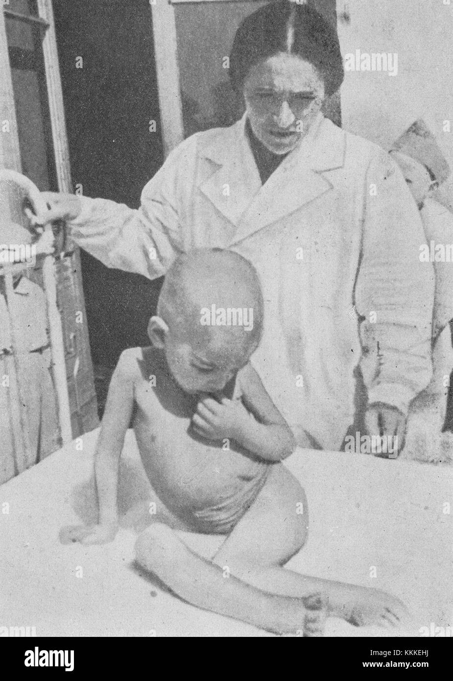 Dieses Forschungsdokument beschreibt klinische Studien zu Hungerkrankheiten während der Hungersnot im Warschauer Ghetto im Jahr 1942. Die Studie hebt die schlimmen Zustände und schwere Unterernährung hervor, unter denen die jüdische Bevölkerung während des Zweiten Weltkriegs litt Stockfoto