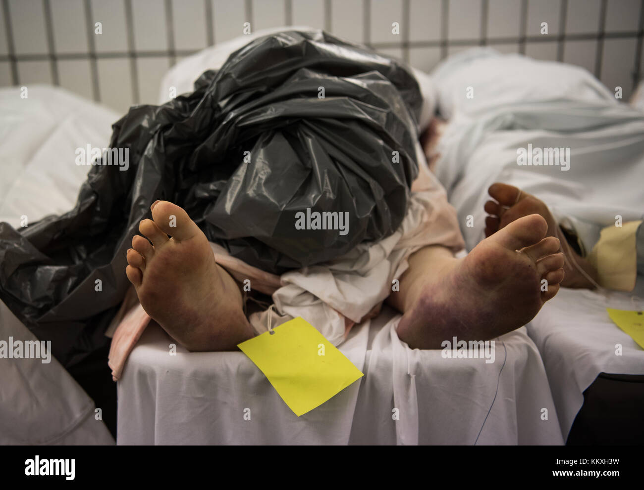 Eine Leiche Liegt In Einer Kuhlkammer Am Institut Fur Forensische Medizin An Der Universitatsklinik In Frankfurt Main Deutschland 27 November 2017 Forensische Wissenschaftler Bis Zu Grunden Der Todesfalle Klarer Versuch Finden Sie Hinweise