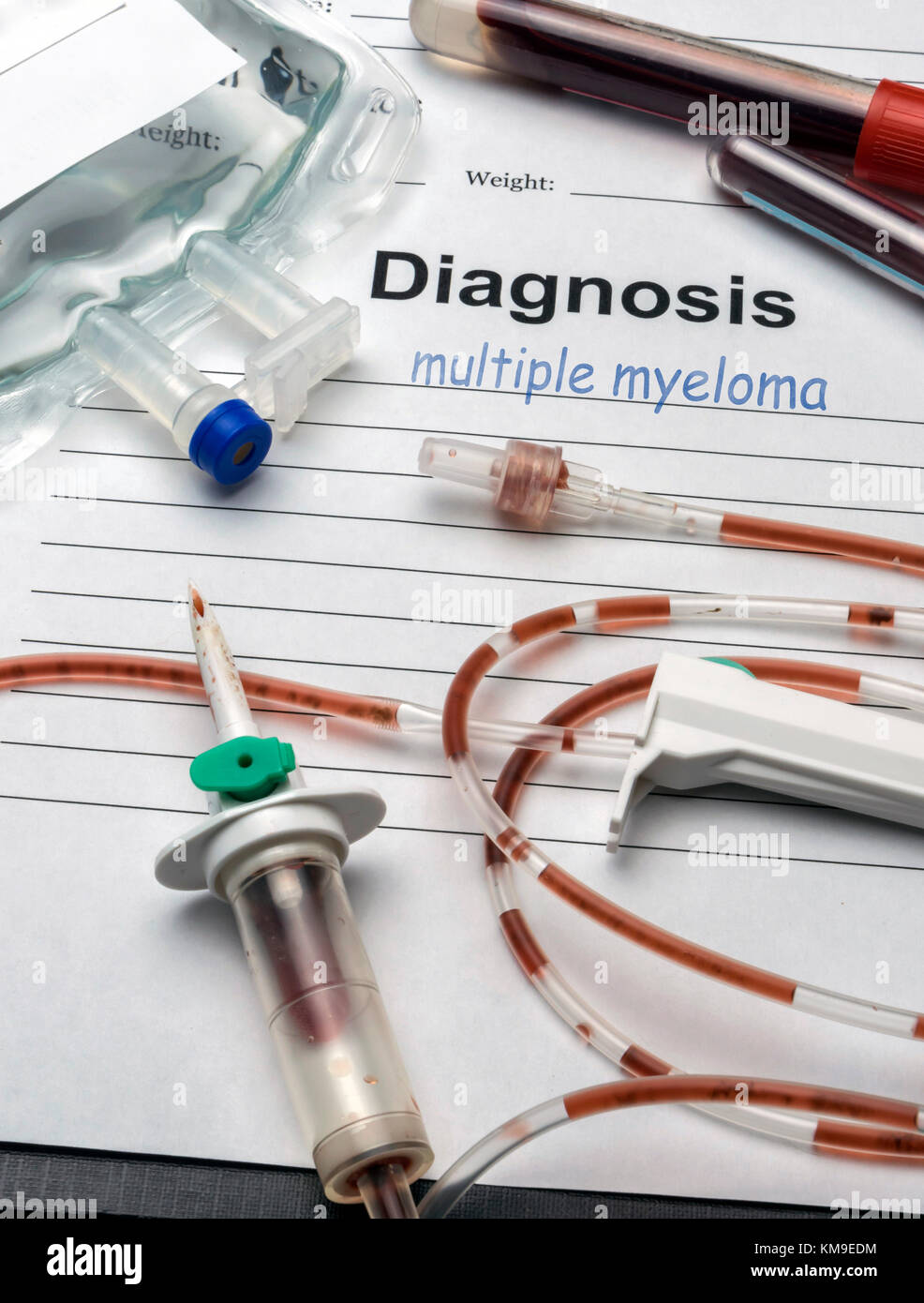 Diagnose Form, multiplem Myelom, tropfbewässerung Ausrüstung mit Spuren von Blut in einem Krankenhaus, konzeptionelle Bild Stockfoto