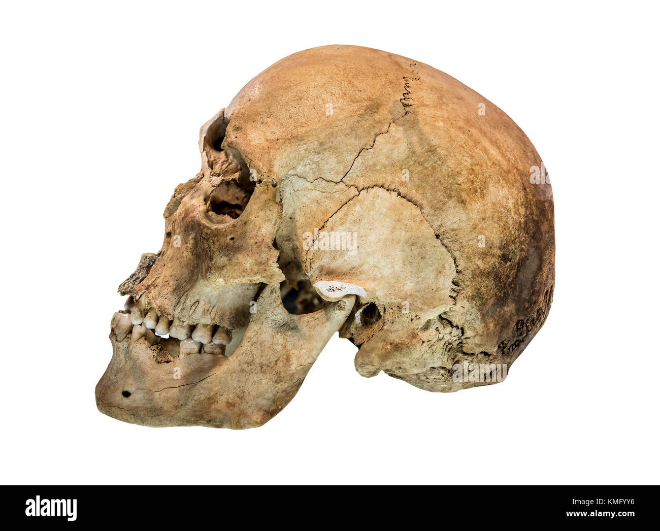 Ansicht von der linken Seite des menschlichen Schädels. Stockfoto Ansicht von der linken Seite des menschlichen Schädels. Stockfoto