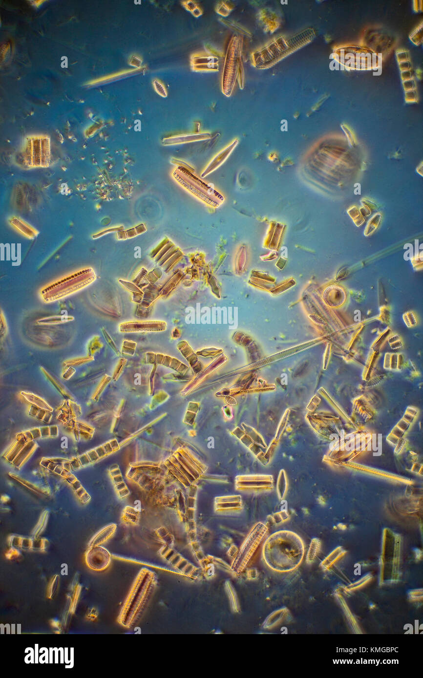 Diatomeen, Amphoren, Synedra, Cocconeisplacendula, Cymbella, Cyclotella, Pinnularia, Meridian circulare. Photomicrograph Stockfoto