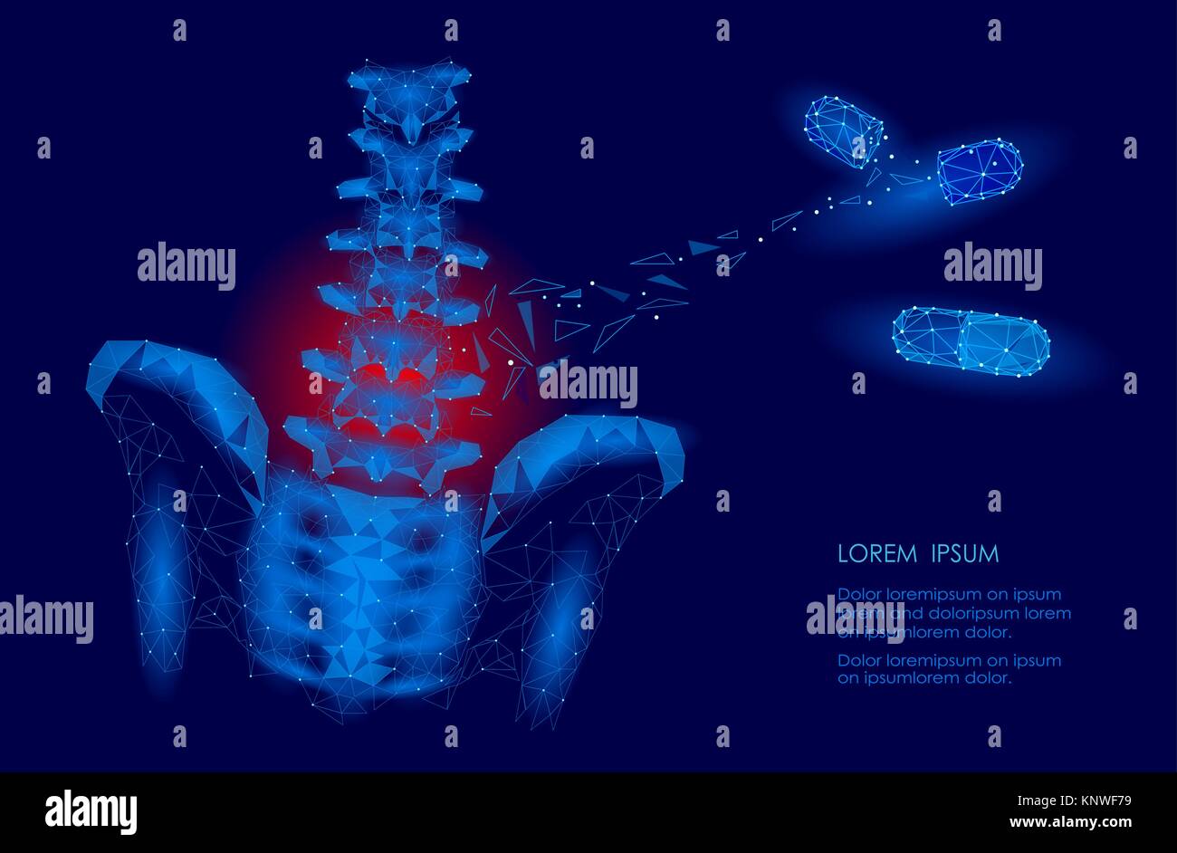 Die menschliche Wirbelsäule Hüfte lumbale Radikulitis Schmerz Low Poly. Geometrische vieleckige Partikelfilter Dreieck Point Line die zukünftige Medizin Technologie blau rot schmerzlichen Bereich Vector Illustration Stock Vektor