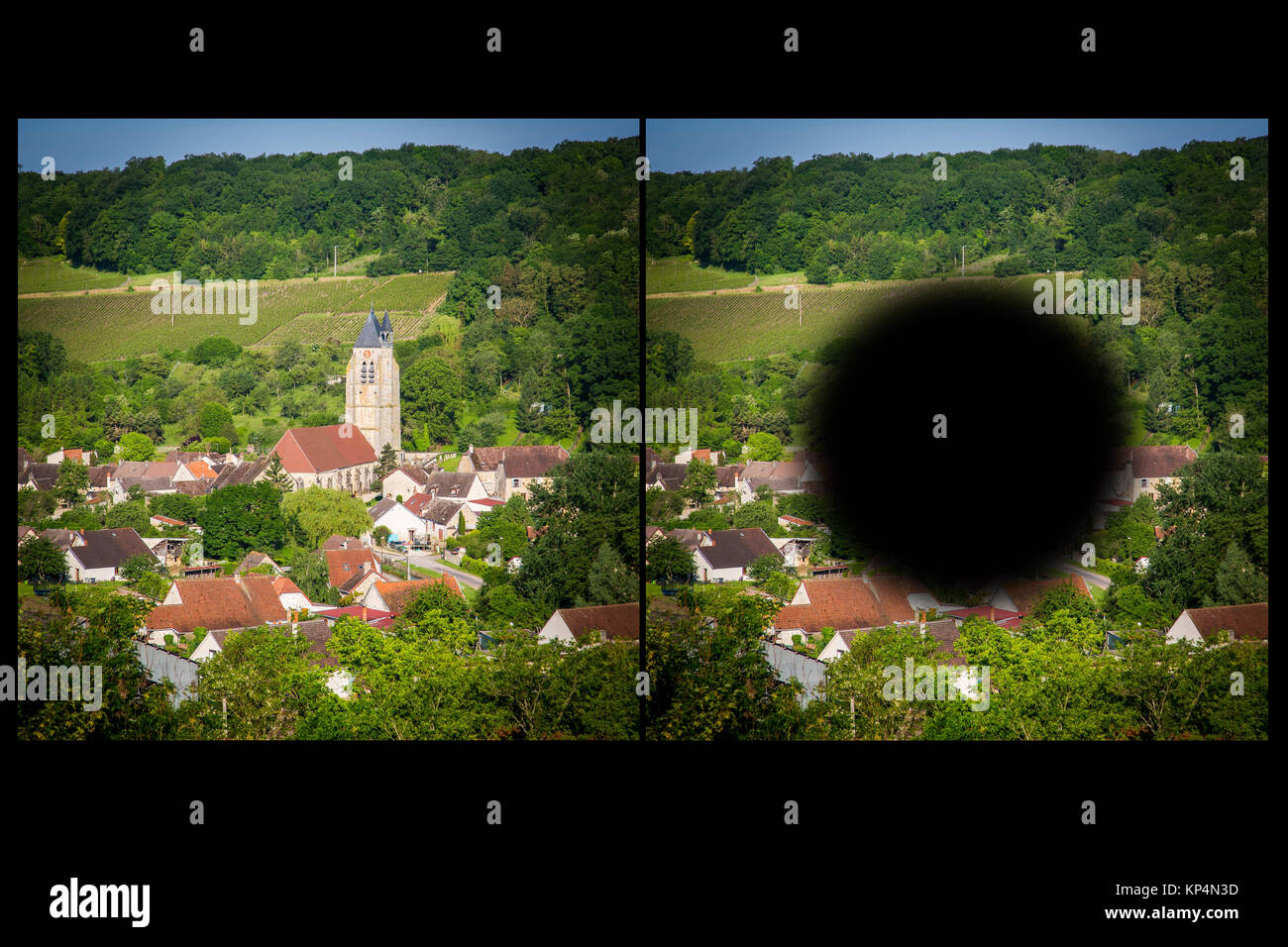 Auf der rechten Seite, die Vision einer Person betroffen durch die altersbedingte Makuladegeneration (AMD). Stockfoto