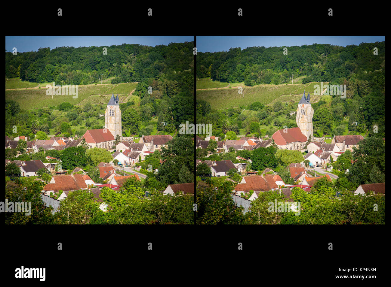Auf der rechten Seite, die Vision einer Person betroffen durch die altersbedingte Makuladegeneration (AMD). Stockfoto