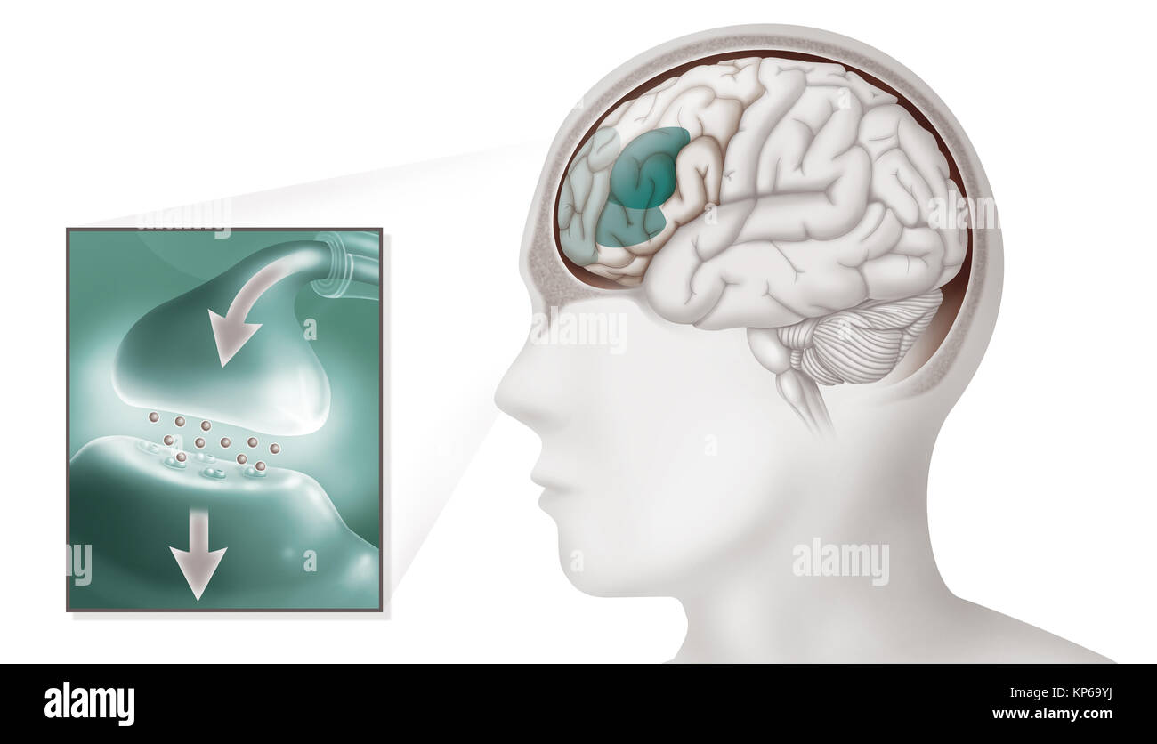 Adhs ABBILDUNG Stockfoto