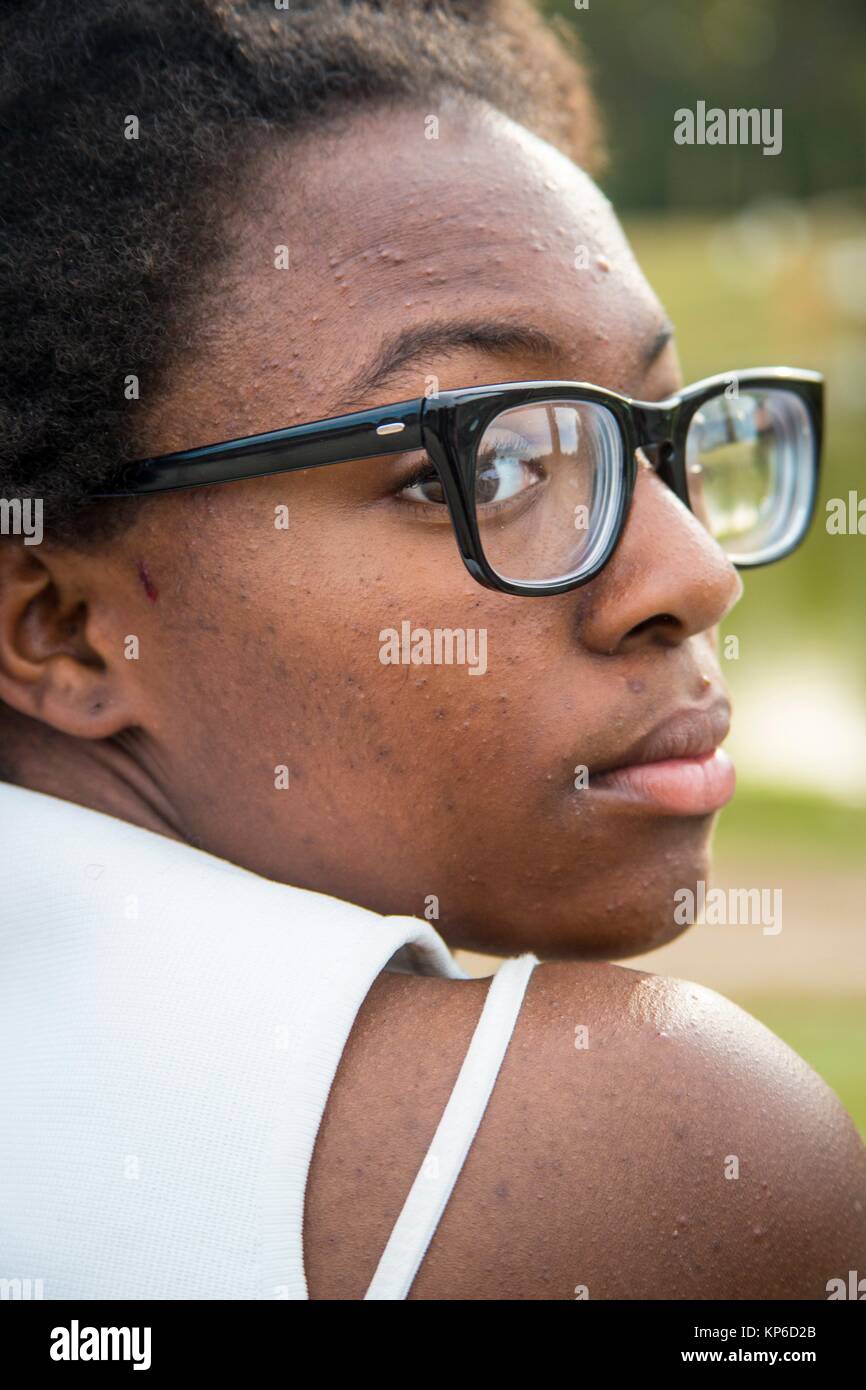 Ein afrikanischer amerikanischer Teenager mit schwarzer Brille schaut ihr  über die Schultern. Ihre weißen Büstenhalterbügel angezeigt wird. Sie sieht  nachdenklich und traurig Stockfotografie - Alamy