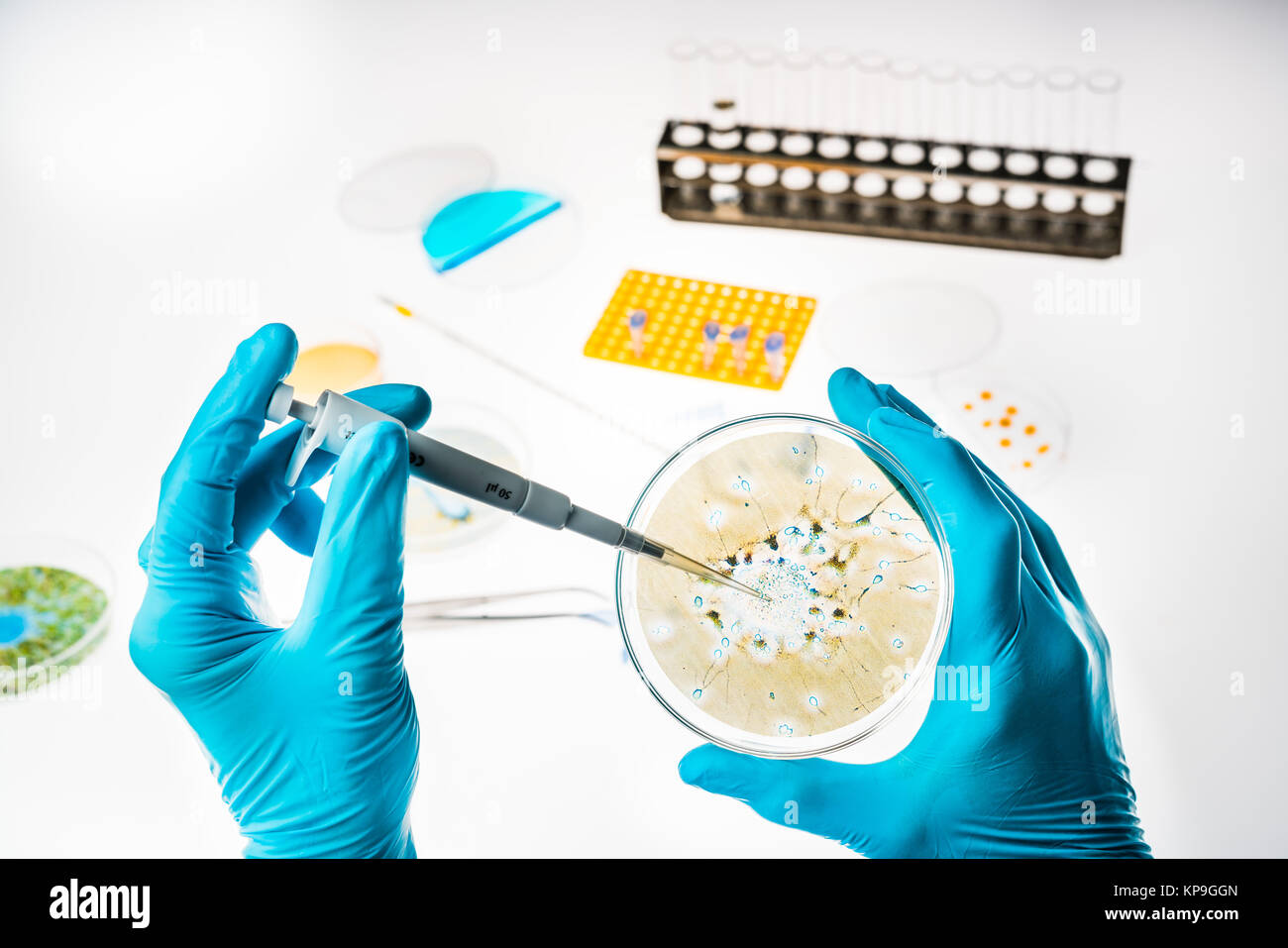 Nervenzelle in einer Petrischale, Forschung zu Alzheimer und anderen Erkrankungen des Gehirns. Stockfoto