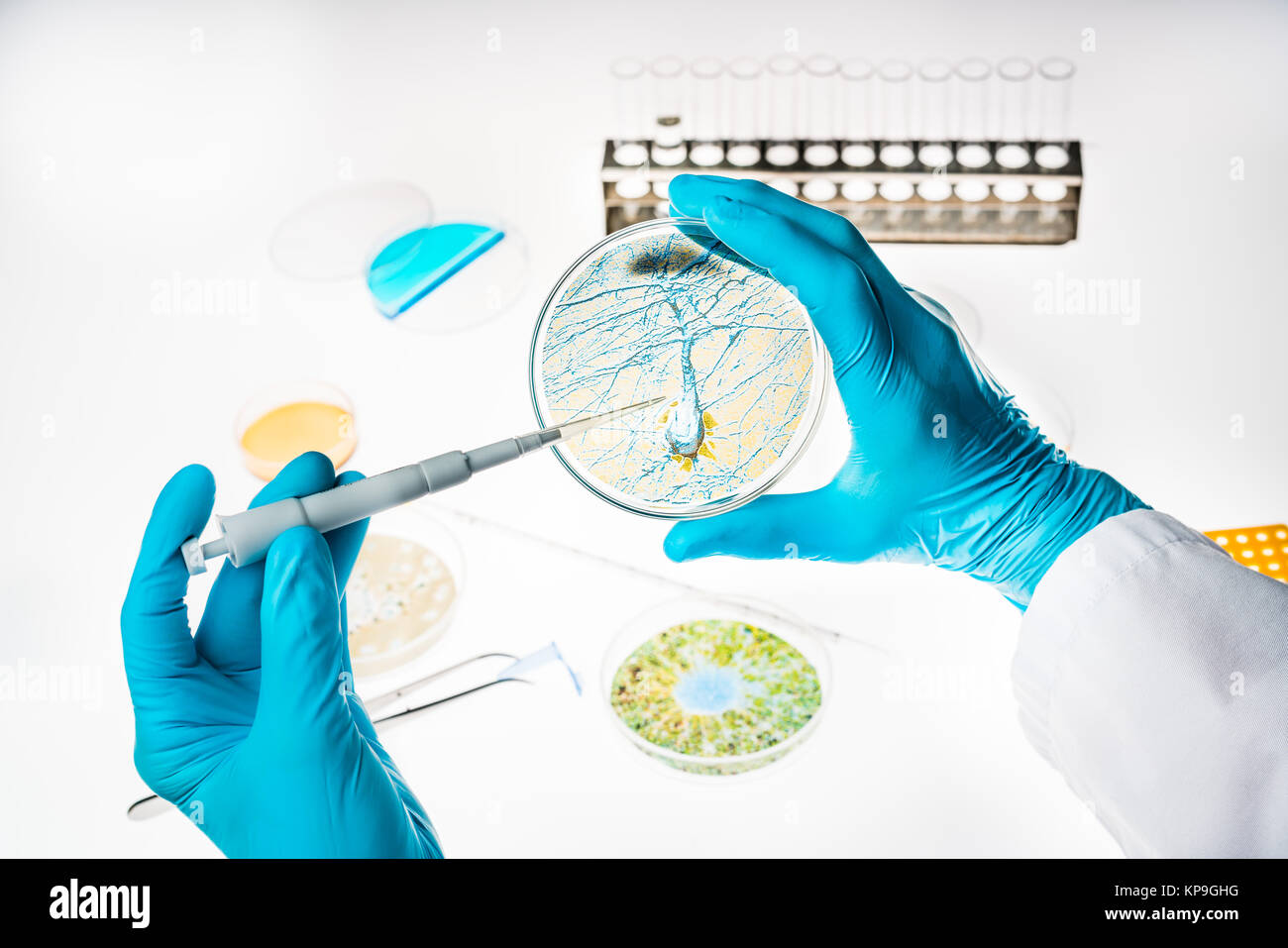 Nervenzelle in einer Petrischale, Forschung zu Alzheimer und anderen Erkrankungen des Gehirns. Stockfoto