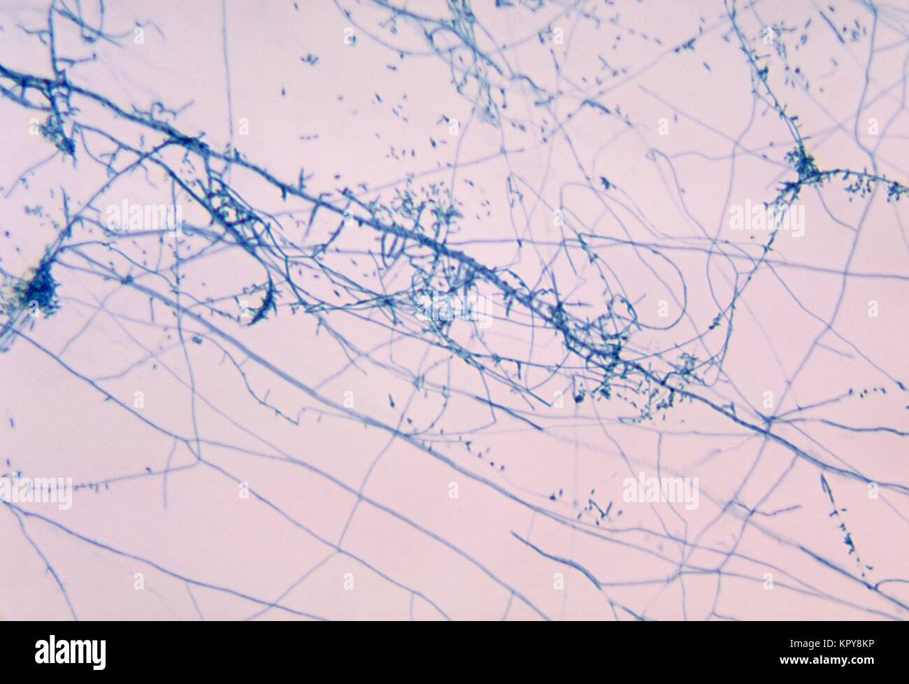 Der Photomicrograph zoophilic Pilz Trichophyton mentagrophytes, 1969. Bild mit freundlicher Genehmigung von CDC/Dr. Leanor Haley. Stockfoto