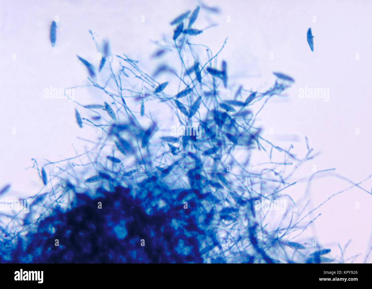 Dies ist ein photomicrograph des Pilzes Microsporum gypseum mithilfe der lactophenol Cotton blue staining Technique. Die dermatophyte M. gypseum, einem natürlichen Boden habitant, können dazu führen, dass tinea corporis und tinea capitis bei Menschen und Tieren, 1969. Anderen dermatophyten sind in der Gattungen Epidermophyton und Trichophyton enthalten. Bild mit freundlicher Genehmigung von CDC/Dr. Leanor Haley. Stockfoto