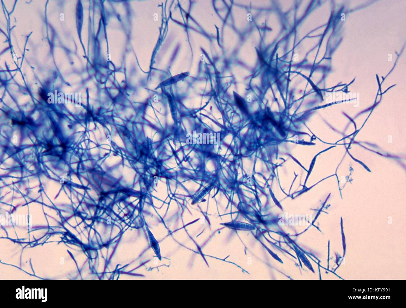 Dies ist ein photomicrograph des Pilzes Microsporum canis mit dem lactophenol Cotton blue staining Technique. M. Canis, einem zoophilic dermatophyte oft mit Hunden und Katzen gefunden wird, ist eine häufige Ursache von Tinea Corporis und tinea capitis bei Menschen, 1969. Anderen dermatophyten sind in der Gattungen Epidermophyton und Trichophyton enthalten. Bild mit freundlicher Genehmigung von CDC/Dr. Leanor Haley. Stockfoto