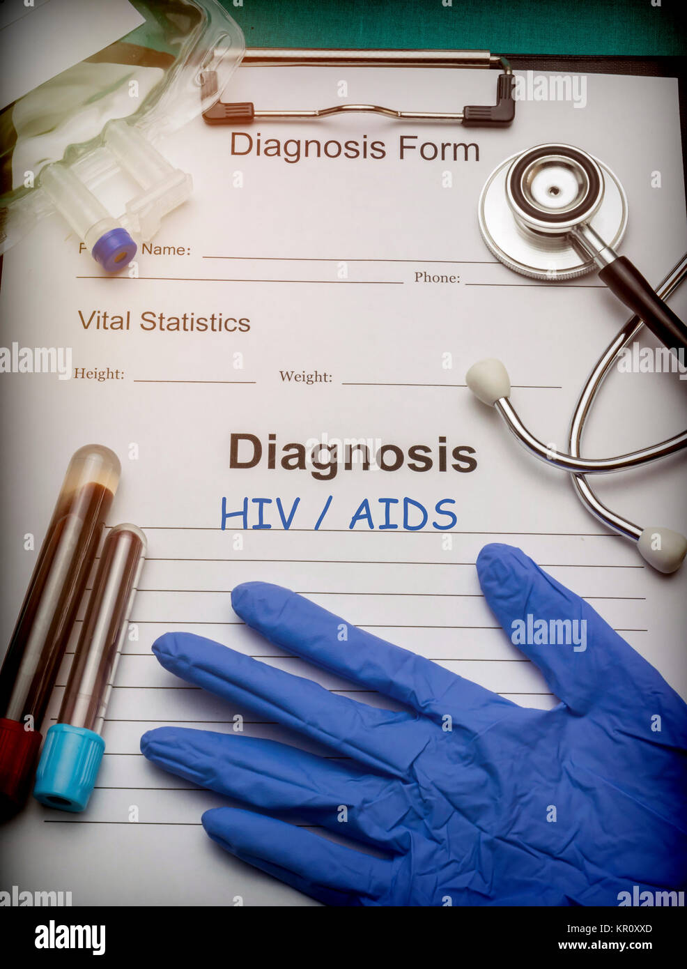 Diagnose, HIV/AIDS, Durchstechflasche mit Blutproben und Medizin eines Krankenhauses, konzeptionelle Bild Stockfoto
