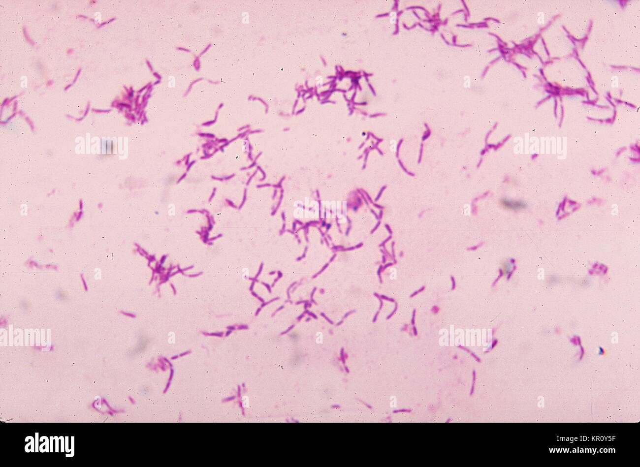 Dieses Bild zeigt die Gram-positive Bakterium Bifidobacterium eriksonii, 1972. B. eriksonii, auch genannt Actinomyceten eriksonii, ist ein anaerobes Bakterium, das ist ein normalerweise vorkommenden Einwohner der Mundhöhle, normalerweise ist keine Krankheit verursachen. Mit freundlicher CDC/Gilda L. Jones. Stockfoto
