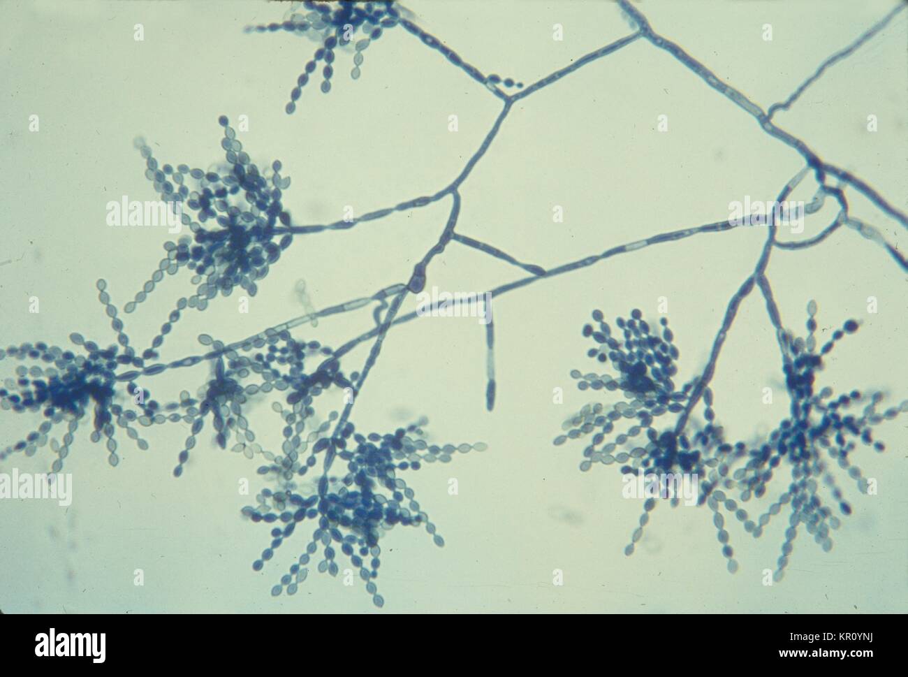 Dargestellt ist eine photomicrograph von Cladophialophora carrionii, vergrößerte 475 X, 1964. Die C. carrionii Pilz ist eine häufige Ursache von chromoblastomycosis Infektionen, und ist besonders verbreitet in ariden und semi-ariden Gebieten, häufig in den tropischen und subtropischen Zonen. Bild mit freundlicher Genehmigung von CDC/Dr. Lucille K. Georg. Stockfoto